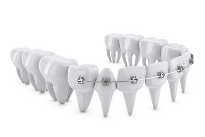 Scopri come gli apparecchi ortodontici possono trasformare il tuo sorriso con i nostri servizi di ortodonzia professionali.
